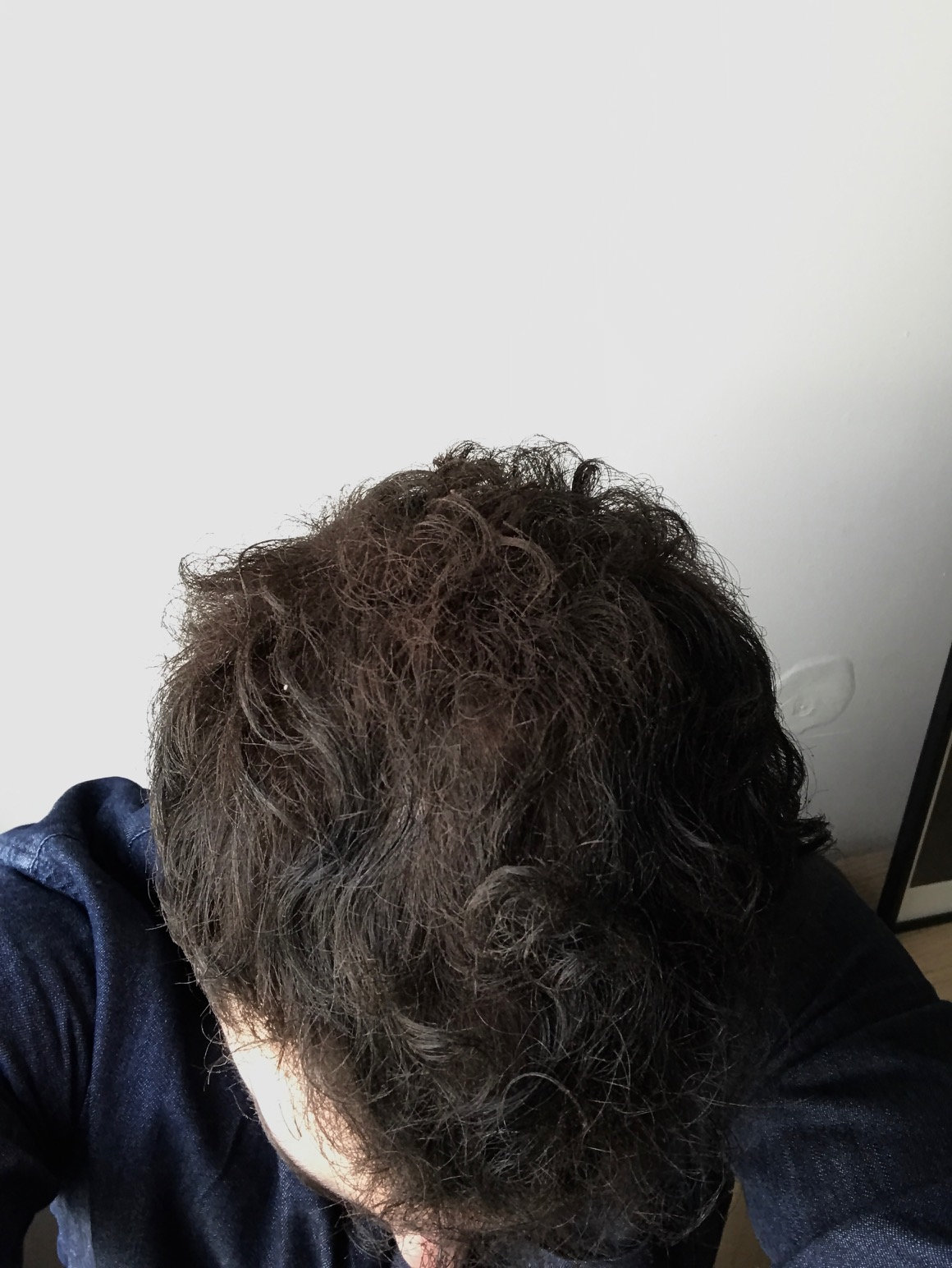 homme chauve utilisant la poudre de cheveux