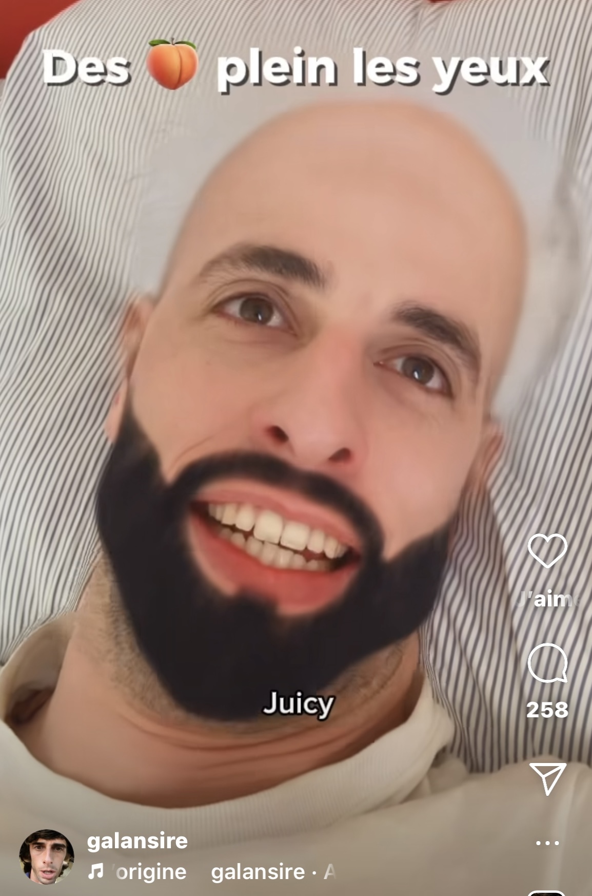 https://www.zupimages.net/up/25/08/jeyu.jpeg