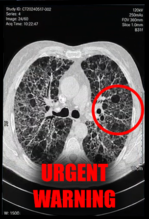 COPD breathing information